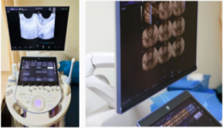 ��׼���ơ��������飺ҽԺ����GE Voluson Expert 18��ά�ʳ�����