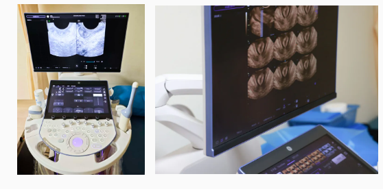 湛江久和医院四维彩超